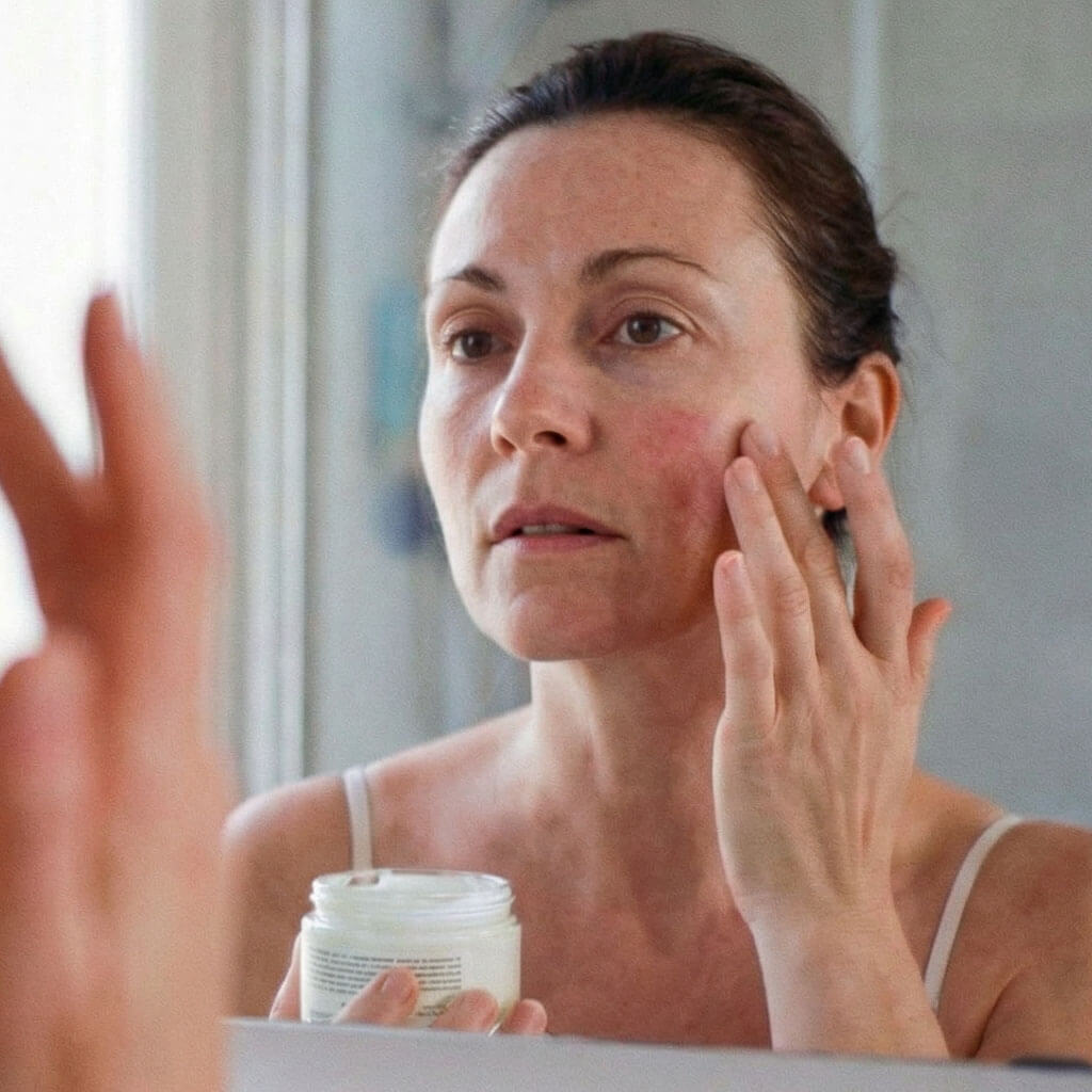 Peau sensible présentant une rougeur localisée avant application d’une crème visage au lait de chèvre